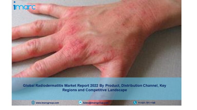 Radiodermatitis Market Size, Industry Share, Growth, Trends and Forecast till 2022-2027