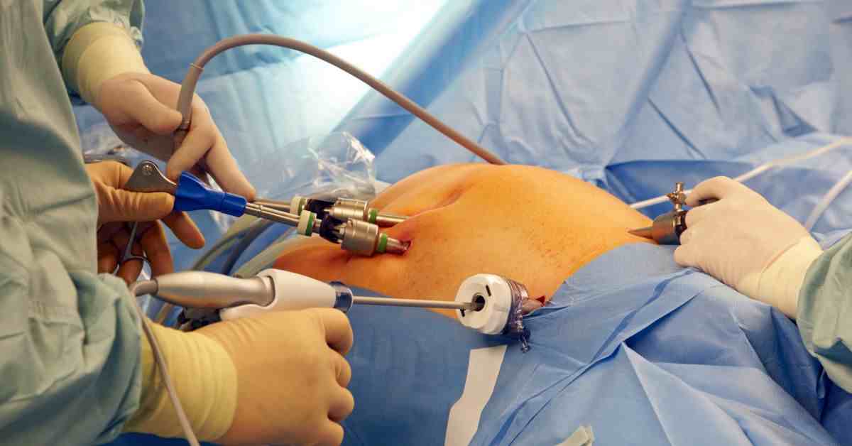 Groundbreaking Tips for Successful Gynecomastia Surgery in Ludhiana: A Comprehensive Guide