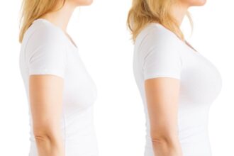 Transform Your Confidence with a Mommy Makeover in Tampa, FL