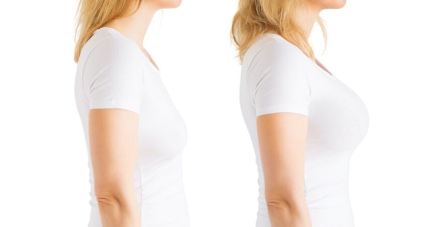 Transform Your Confidence with a Mommy Makeover in Tampa, FL